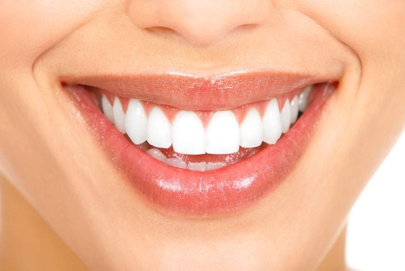 Teeth Whitening Newcastle Charlestown Dental Centre